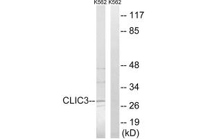 Western blot analysis of extracts from K562 cells, using CLIC3 antibody. (CLIC3 anticorps  (Internal Region))