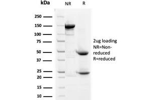 SDS-PAGE Analysis Purified Prohibitin Mouse Monoclonal Antibody (SPM311).