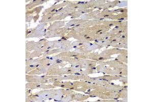 Immunohistochemistry of paraffin-embedded rat heart using PSMB8 antibody (ABIN5975113) at dilution of 1/100 (40x lens).