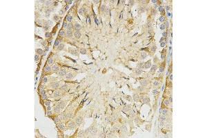 Immunohistochemistry (IHC) image for anti-Tropomyosin-2 (TPM2) antibody (ABIN3017365)