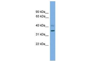 WB Suggested Anti-SLC25A48 Antibody Titration: 0. (SLC25A48 anticorps  (C-Term))