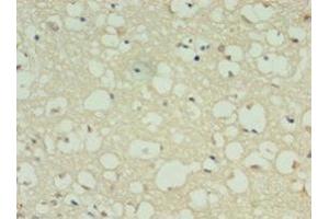 Immunohistochemistry of paraffin-embedded human brain tissue using ABIN7149470 at dilution of 1:100 (DRD5 anticorps  (AA 361-477))