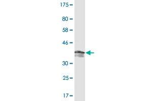 Western Blot detection against Immunogen (37. (PDE5A anticorps  (AA 29-138))