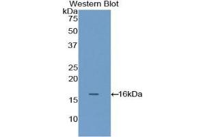 Western blot analysis of the recombinant protein.