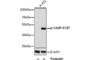 Western blot analysis of extracts of  cells, using Phospho-VASP-S157 antibody (ABIN6135335, ABIN6136286, ABIN6136287 and ABIN6225657) at 1:2000 dilution. (VASP anticorps  (pSer157))
