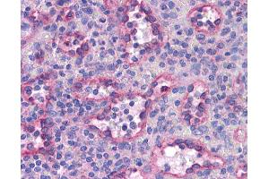 Anti-SREBP-2 antibody IHC of human spleen.