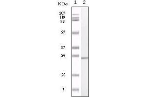Western blot analysis using S100A mouse mAb against truncated S100A recombinant protein. (S100A1 anticorps)