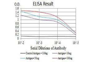 Black line: Control Antigen (100 ng),Purple line: Antigen (10 ng), Blue line: Antigen (50 ng), Red line:Antigen (100 ng)