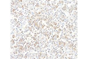 anti-CD96 (CD96) (AA 29-502) antibody