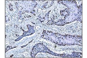 IHC analysis of Ki67 using anti-Ki67 antibody (ABIN7601100). (Ki-67 anticorps  (AA 2860-3256))