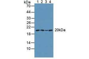 Figure. (ARPC4 anticorps  (AA 3-165))