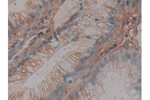 Detection of AT in Human Rectum Tissue using Monoclonal Antibody to Antithrombin (AT)