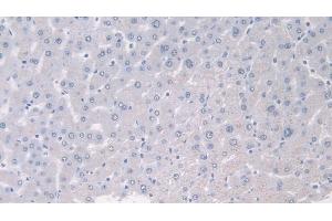 Detection of PANK4 in Human Liver Tissue using Polyclonal Antibody to Pantothenate Kinase 4 (PANK4)
