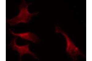 ABIN6269112 staining K562 by IF/ICC. (LYN anticorps  (C-Term))