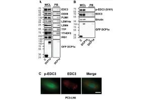 Western Blot and Immunofluorescence of Anti-EDC3 phosho S161 status in P-bodies.