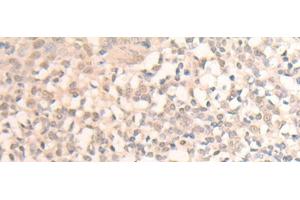 Immunohistochemistry of paraffin-embedded Human tonsil tissue using MLLT6 Polyclonal Antibody at dilution of 1:40(x200) (MLLT6 anticorps)