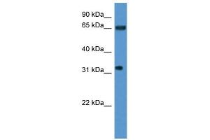 Western Blot showing SRRM4 antibody used at a concentration of 1-2 ug/ml to detect its target protein. (SRRM4 anticorps  (Middle Region))