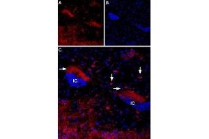 Expression of Muscarinic acetylcholine receptor M4 in mouse islands of Calleja - Immunohistochemical staining of mouse islands of Calleja (ventral striatum) using Anti-CHRM4 Antibody (ABIN7043064, ABIN7044584 and ABIN7044585).