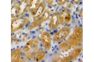 Used in DAB staining on fromalin fixed paraffin-embedded Kidney tissue (LAMC2 anticorps  (AA 28-196))
