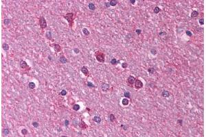 Human Brain, Cortex, White Matter (formalin-fixed, paraffin-embedded) stained with HTR1A antibody ABIN214777 at 2.