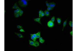 Immunofluorescence staining of HepG2 cells with ABIN7145104 at 1:333, counter-stained with DAPI. (ATG16L1 anticorps  (AA 1-607))