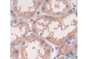 IHC-P analysis of Human Tissue, with DAB staining. (SLIT1 anticorps  (AA 345-623))