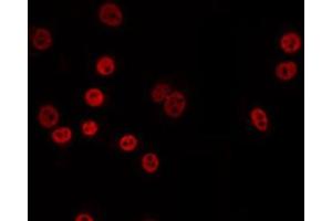 anti-Alanyl-tRNA Synthetase Domain Containing 1 (AARSD1) (Internal Region) antibody