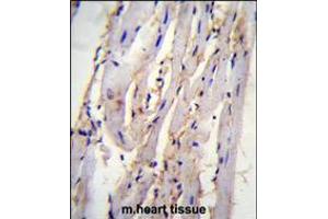 STX19 Antibody immunohistochemistry analysis in formalin fixed and paraffin embedded m. (Syntaxin 19 anticorps  (C-Term))
