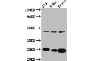 Western Blot Positive WB detected in: NIH/3T3 whole cell lysate, K562 whole cell lysate, Mouse Brain whole cell lysate All lanes: CDC42 antibody at 1:1000 Secondary Goat polyclonal to rabbit IgG at 1/50000 dilution Predicted band size: 22, 22 kDa Observed band size: 24 kDa (Recombinant CDC42 anticorps)