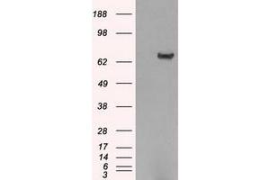 Image no. 2 for anti-Histone Deacetylase 10 (HDAC10) antibody (ABIN1498609) (HDAC10 anticorps)