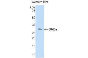 Western blot analysis of recombinant Mouse CFD. (Adipsin anticorps  (AA 1-259))