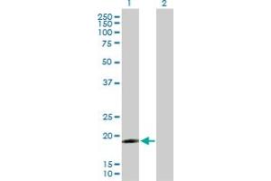 Western Blot analysis of IFNA17 expression in transfected 293T cell line by IFNA17 MaxPab polyclonal antibody. (IFNA17 anticorps  (AA 1-189))