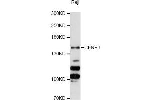 Western blot analysis of extracts of Raji cells, using CENPJ Antibody (ABIN5996394) at 1:3000 dilution. (CENPJ anticorps)
