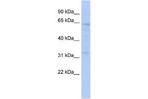 WB Suggested Anti-ZNF530 Antibody Titration:  0. (ZNF530 anticorps  (Middle Region))