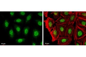 ICC/IF Image RAG2 antibody detects RAG2 protein at nucleus by immunofluorescent analysis.