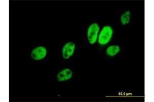 Immunofluorescence of purified MaxPab antibody to ERCC8 on HeLa cell. (ERCC8 anticorps  (AA 1-396))