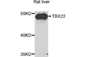 Western blot analysis of extracts of rat liver, using TBX22 antibody (ABIN5975188) at 1/1000 dilution. (T-Box 22 anticorps)