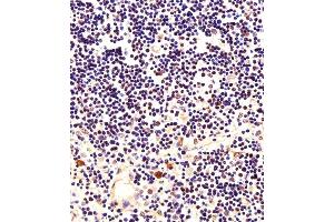 Immunohistochemical analysis of paraffin-embedded H. (NPM1 anticorps)