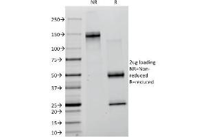 SDS-PAGE Analysis Purified Creatine Kinase-B (CKB) Mouse Monoclonal Antibody (CKB/1268).