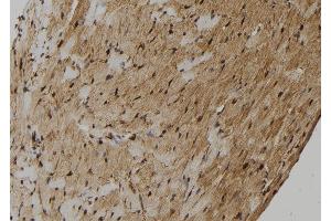 ABIN6272467 at 1/100 staining Mouse heart tissue by IHC-P.
