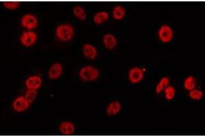 ABIN6274840 staining LOVO by IF/ICC. (APBB2 anticorps  (Internal Region))