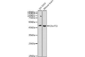 Western blot analysis of extracts of various cell lines, using C9orf72 antibody (ABIN7266391) at 1:1000 dilution. (C9ORF72 anticorps  (AA 1-230))