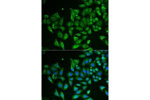 Immunofluorescence analysis of HeLa cells using CLEC3B antibody (ABIN5973819). (CLEC3B anticorps)