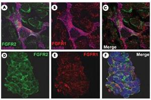 FGFR2/isolectinB4 (A) and FGFR1/isolectinB4 (B) staining of apparent mesenchymal cells and the subpopulation of endothelial cells. (FGFR2 anticorps  (AA 22-51))
