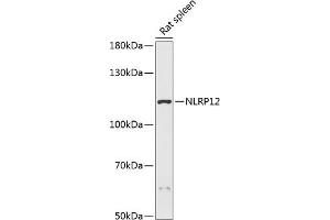 Western blot analysis of extracts of rat spleen, using NLRP12 antibody (ABIN7268937) at 1:3000 dilution. (NLRP12 anticorps  (AA 862-1062))