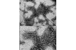 Electron Microscopy (EM) image for Synuclein, alpha (SNCA) (Ala53Thr-Mutant) (Active) protein (ABIN6952303)