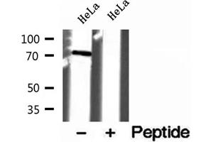 Western blot analysis of extracts of HeLa cells, using VPS33B antibody. (VPS33B anticorps)