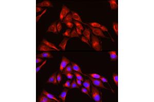Immunofluorescence analysis of U2OS cells using TRIM4 Rabbit pAb (ABIN7270999) at dilution of 1:250 (40x lens). (TRIM4 anticorps  (AA 1-280))