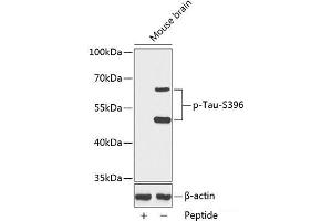 Western blot analysis of extracts from Mouse brain tissue using Phospho-Tau(S396) Polyclonal Antibody. (tau anticorps  (pSer396))