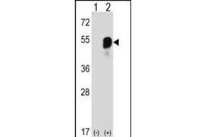Western blot analysis of RS2 (arrow) using rabbit polyclonal RS2 Antibody (C-term) (ABIN6242575 and ABIN6577319). (PARS2 anticorps  (C-Term))